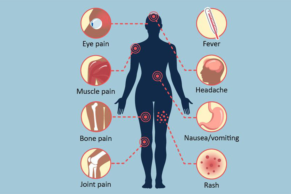 علائم تب دِنگی