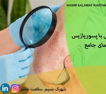 خداحافظی با پسوریازیس؛ راهنمای جامع