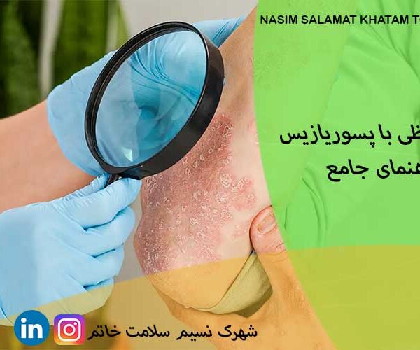 خداحافظی با پسوریازیس؛ راهنمای جامع