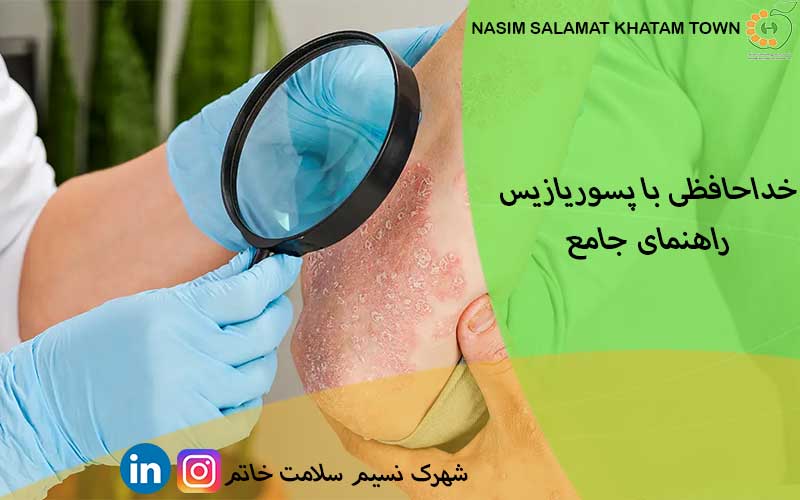 خداحافظی با پسوریازیس؛ راهنمای جامع