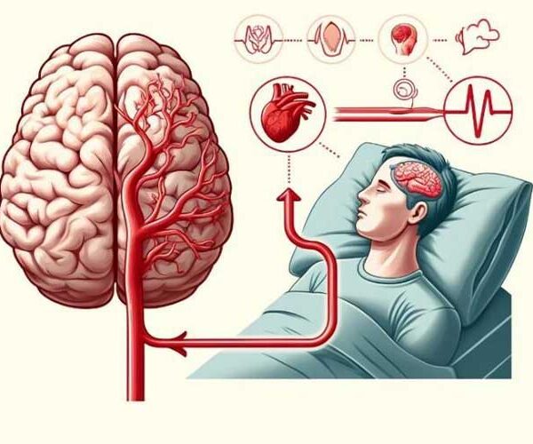 ادعاهای رایج در مورد سکته مغزی در خواب