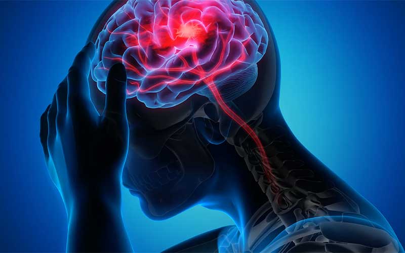 همه آنچه باید درمورد سکته مغزی بدانید