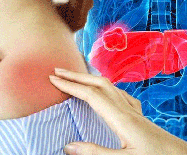 اهمیت مراقبت از پوست در بیماران کبدی