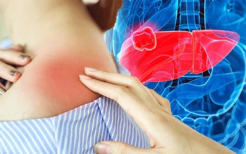 اهمیت مراقبت از پوست در بیماران کبدی