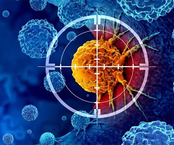تحولی جدید در شخصی‌سازی درمان سرطان با هوش مصنوعی
