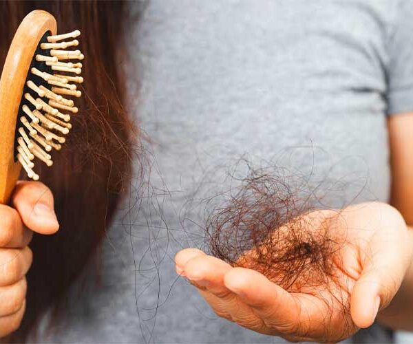 راهکارهایی برای پیشگیری از ریزش مو در فصل گرما