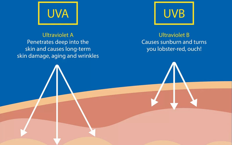 نور خورشید؛ دوست یا دشمن پوست پسوریازیسی؟